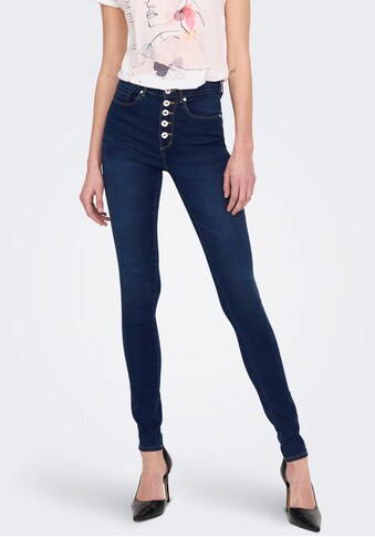 ONLY High-waist-Jeans »ONLROYAL HW SK FLY BTN GUA DK BLUE BOX« kaufen